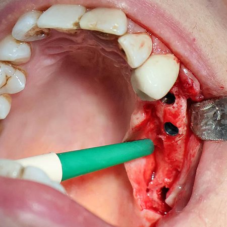 troppi dentisti in italia?